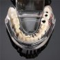Dental Implant Disease Teeth Model Restoration Overdenture Demo Implants Tooth