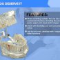 Dental Implant Disease Teeth Model Restoration Overdenture Demo Implants Tooth