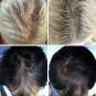 iRestore Laser Hair Growth System FDA-Cleared Hair Loss Treatment for Men&Women