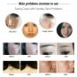 110-220V Freckle Removal Machine Handheld Picosecond Beauty Care Pen Laser Pen B