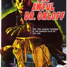 The Awful Dr. Orlof (1962) - Howard Vernon  Colorized Version  DVD
