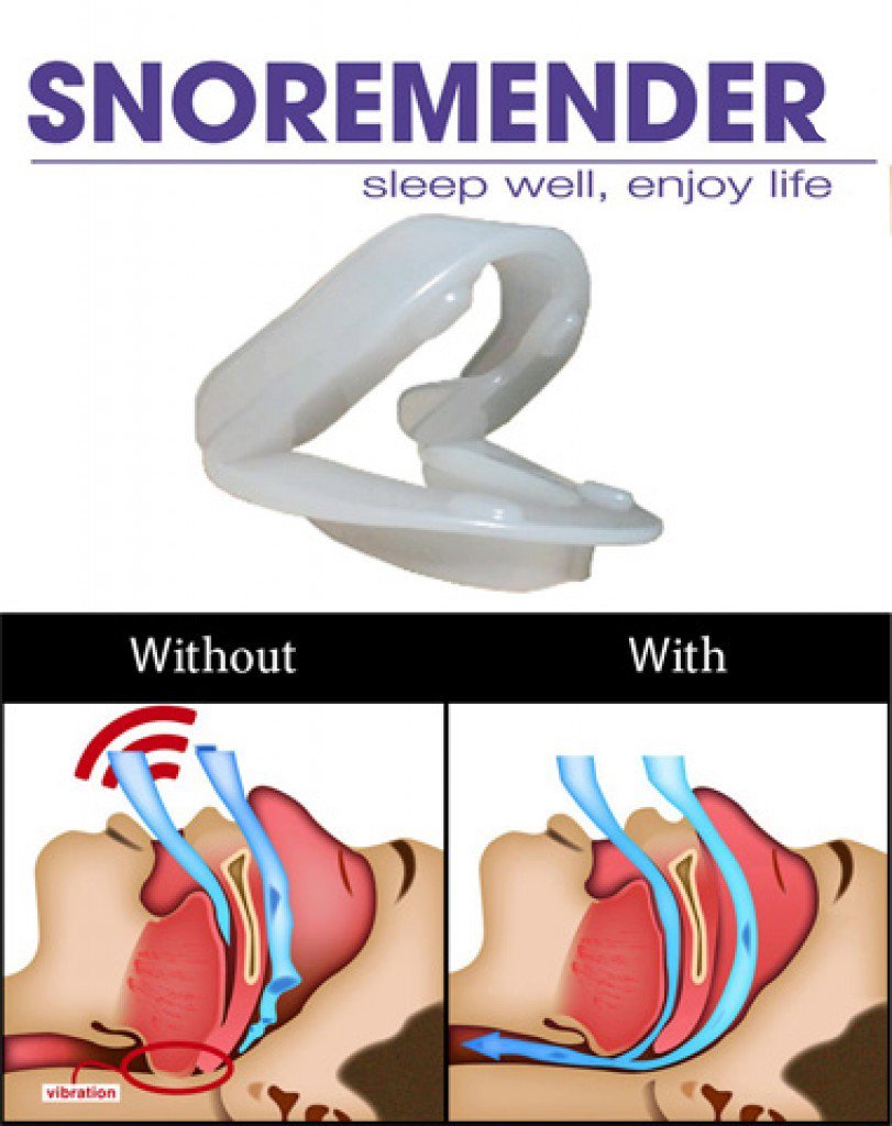 SnoreMender Stop Snoring Device - Enjoy Good Nights Sleep