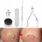 Ingrown Toenail Lifter & Correction Tool Recover Toe Nail Fixer Straightener New