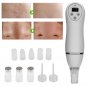 Diamond Microdermabrasion Vacuum Peeling Skin Rejuvenation Dermabrasion Machine