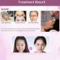 RF Radio Frequency Face Skin Rejuvenation Lifting Wrinkle Removal Beauty Machine