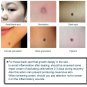 Professional Beauty Machine Wrinkle Removal Facial Skin Care Anti-aging Device
