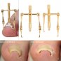 Pure Copper Ingrown Toe Nail Corrector Toenail Fixer Recover Tool & Nail Brace