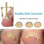 Pure Copper Ingrown Toe Nail Corrector Toenail Fixer Recover Tool & Nail Brace