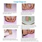 Pure Copper Ingrown Toe Nail Corrector Toenail Fixer Recover Tool & Nail Brace