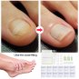 New Ingrown Toe Nail Correction Pedicure Fixer Straightener Clippers Recover Set