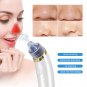 Electric Blackhead Vacuum Cleaner Suction Dermabrasion Removal Scar Acne Pore