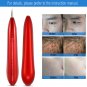 Laser Spot Removal Pen Pigment Spot Freckle Winkle Removal Facial Beauty Cleaner