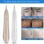 Laser Spot Removal Pen Pigment Spot Freckle Winkle Removal Facial Beauty Cleaner