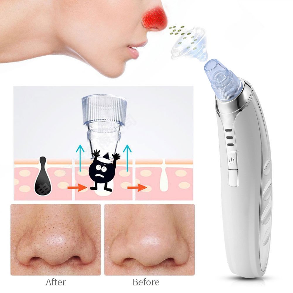 Facial Pore Cleanser Cleaner Face Blackhead Zit Acne Remover Skin Cleansing Tool