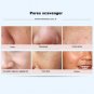 Facial Pore Cleanser Cleaner Face Blackhead Zit Acne Remover Skin Cleansing Tool