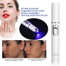 Blue-Ray Therapy Pen Acne Scar Facial Skin Blemish Wrinkle Removal Treatment