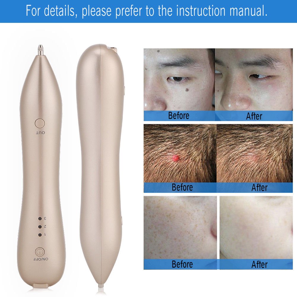 USB Ion Mole Spot Removal Machine Freckle Tattoo Remover Pen + 5Pcs Needles