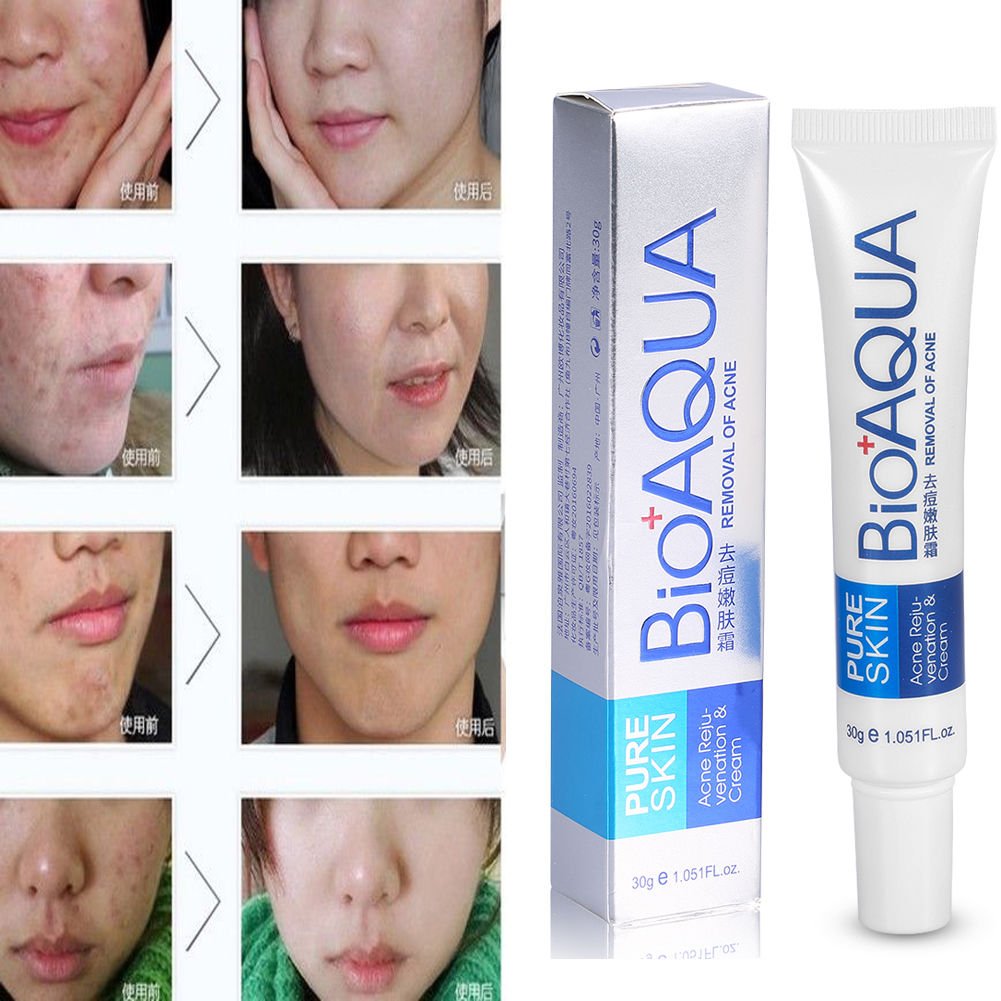 BIOAQUA Face Skin Care Acne Removal Cream Spots Scar Blemish Marks Authentic