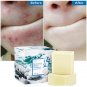 100g Natural Goats Milk Soap Bar Acne Treatment Sea Salt Soap