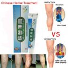 Medical Varicose Veins Treatment Leg Acid Bilges Itching Lumps Vasculitis Cream
