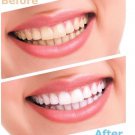 Advanced Teeth Whitening Strips (8 Strips) 4 Upper and 4 Lower~Hydrogen Peroxide Advanced Teeth Whitening Strips (8 Strips) 4 Upper and 4 Lower~Hydrogen Peroxide