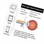 Gamma Ray Blue Light Blocking Glasses Amber Tint Anti Glare UV Digital Eyestrain