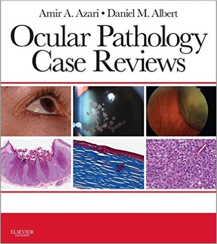 Ebook 978-0323287951 Ocular Pathology Case Reviews