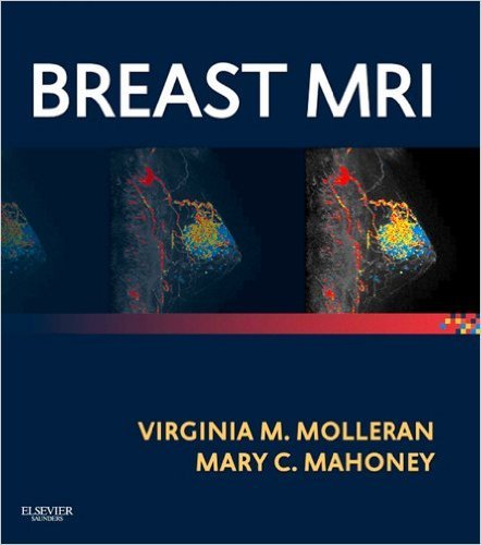 Ebook 978-1455740611 Breast MRI