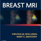 Ebook 978-1455740611 Breast MRI