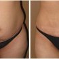 Way to Lose Weight 100 Caps. GARCINIA CAMBOGIA SENNA.Weight Loss Herbal laxative
