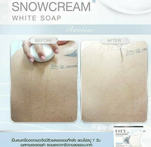1x SNOWCREAM SOAP  Skin Bleaching REDUCE ACNE,Rashes, Bright, KILL VIRUS. 130G.