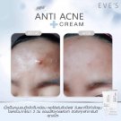 ANTI ACNE  Set. Vulgaris Acne, clogged acne, ACNE DRY QUICKLY. Caviar+Lava Water