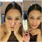 ANTI ACNE Set. Vulgaris Acne, clogged acne, ACNE DRY QUICKLY. Caviar+Lava Water