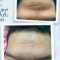3x HYALURON CONCENTRATE SERUM 20g. Anti aging. Moisture, Elasticity. Radiant
