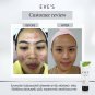 3 Steps Acne Clear Set. Pimples, clogged acne, inflamed Acne, ACNE DRY Quick