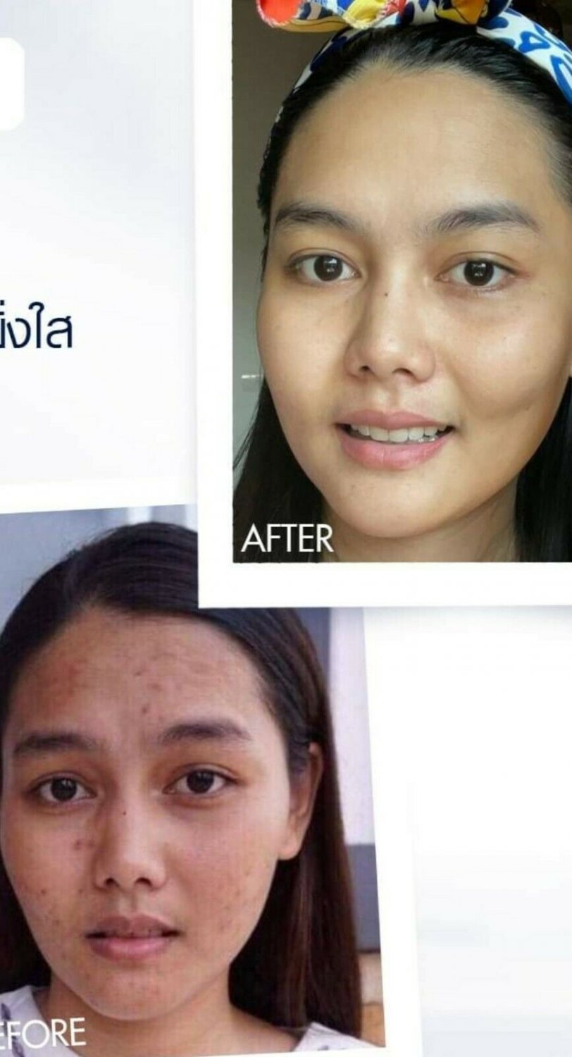 Rejuvinate. Horse Placenta Serum. Cell repair.DEEPLY NOURISH.Tight Bright >Eve's