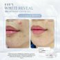 1X WHITENING &BRIGHTENING CREAM GEL 20g. Skin Smooth, Radiant,CLEAR, SOFT.