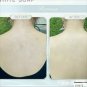 5x Soap Skin Bleaching REDUCE ACNE,Rashes, Bright, KILL VIRUS. SNOWCREAM 130G.
