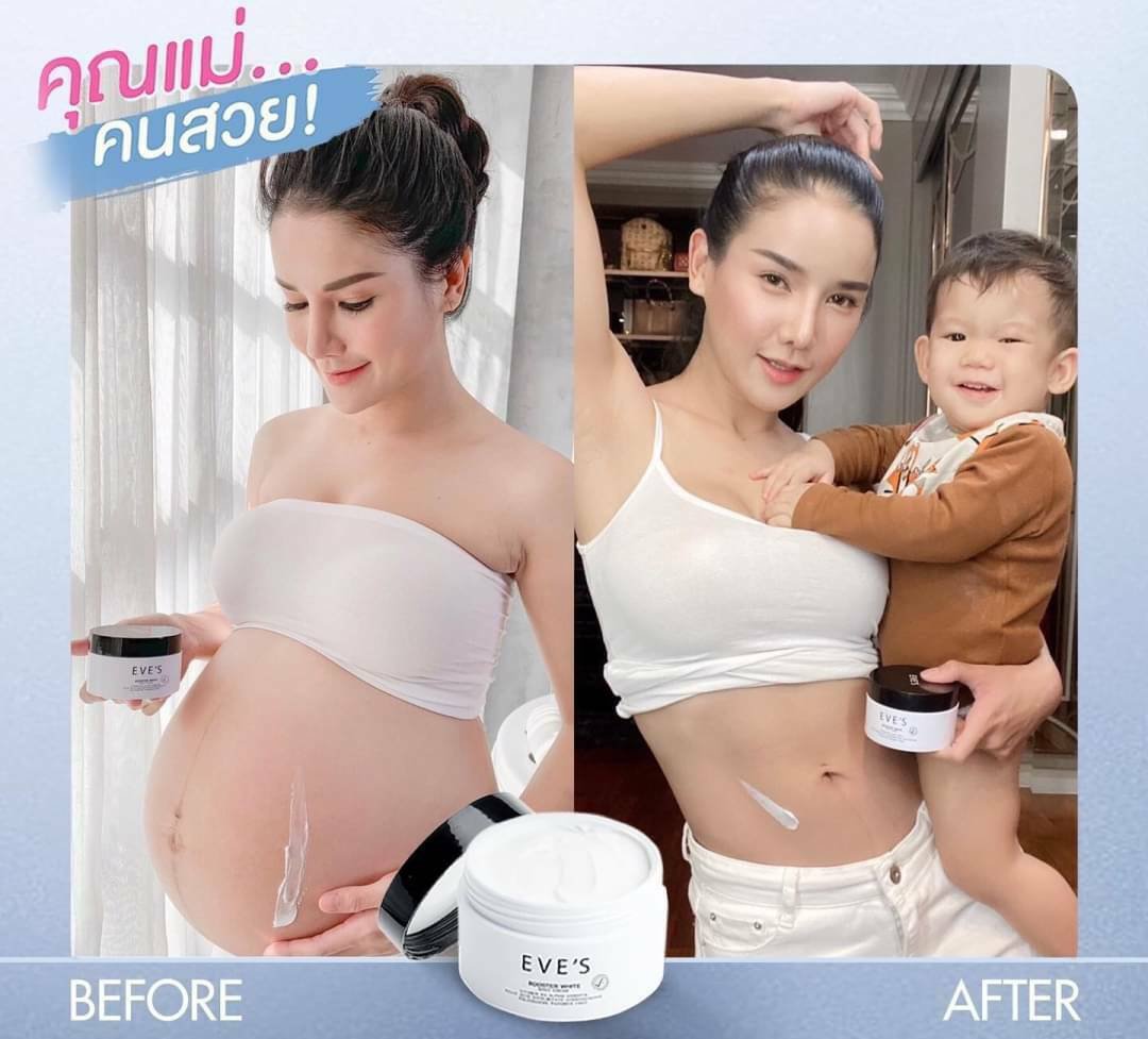 100 ml. Stretch Marks, Dark Spot Bright White.Booster White&Acirc;&nbsp; Cream+Vitamin B3