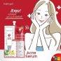 3x Snowgirl Acne Serum 8g. with Zinc PCA, Sulfur, BHA, AHA, Witch Hazel, Lemon