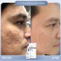 Horse Placenta Serum.Rejuvinate. Cell repair.DEEPLY NOURISH.Tight. Bright. 20ml.