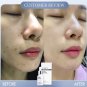 Horse Placenta Serum.Rejuvinate. Cell repair.DEEPLY NOURISH.Tight. Bright. 20ml.