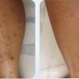5X 100ml. Body White Booster Cream +Vitamin B3+Aloe. Stretch marks, scars.Bright