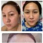 5x Horse Placenta. -Wrinkles Darkmarks Acnes.Glow Bright Revital. Q Double Serum