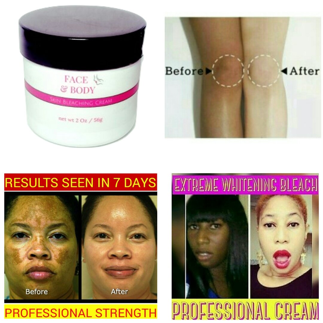 Professional Skin Lightening Bleaching Cream