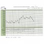 Digital Fahrenheit Basal Thermometer +10 Ovulation +10 Pregnancy Test Kits+Chart