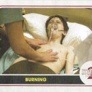 Topps Stranger Things Season 2 Trading Card #ST-65 Burning
