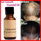 NEW Revitalize Organic Hair Growth Essence [ Big Promotion] - Free Shipping !