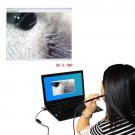 Multifunctional HD Visual Ear Spoon Mini USB Ear Cleaning Endoscope for PC