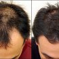 50 ml. SAMORN HAIR SERUM REDUCES STIMULATE HAIR LOSS REGROWTH AUTHENTIC